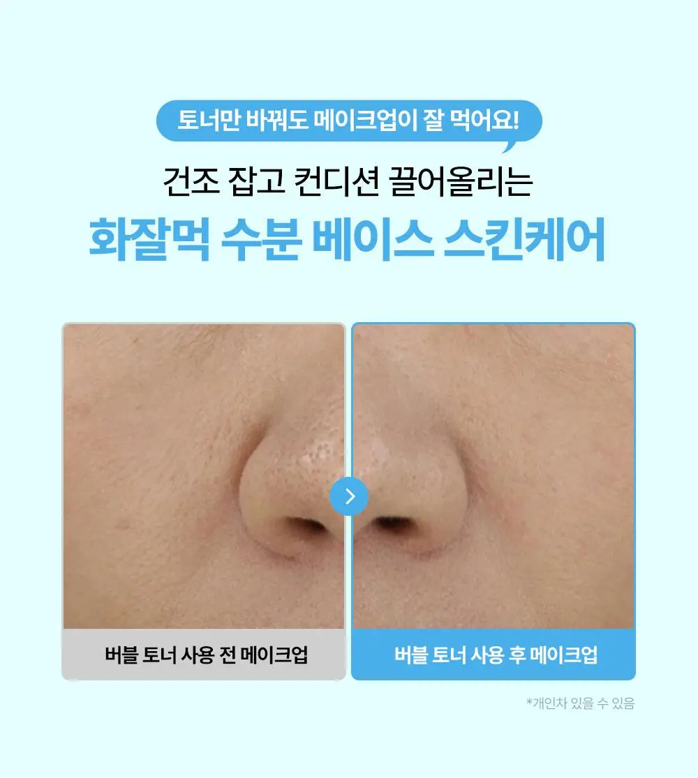 [NEW/버블수분] 리얼베리어 워터리 히알 버블 토너 140ml 상세페이지 17